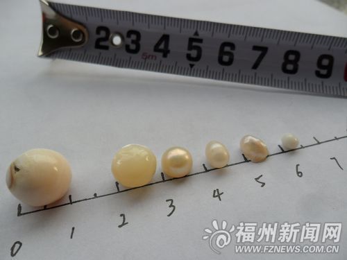 1顆珍珠放糯米中9年後竟然生出5顆珍珠？