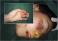 狂男持刀猛捅10歲男童傷口貫面舌頭幾斷裂(圖)
