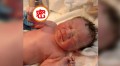 男婴“手握避孕环”强势出生(组图)