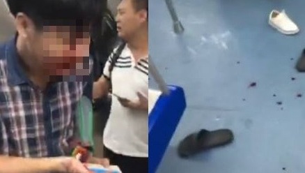 深圳地鐵爆推擠事件釀15傷