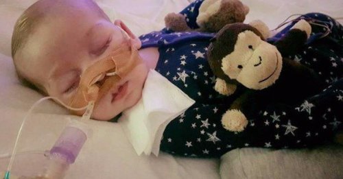 英国一名11个月大的婴儿小查理因先天基因缺失，患罕见疾病，要依靠仪器为生。
