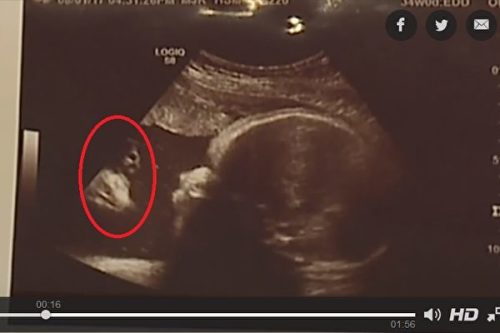 胎儿超音波扫描竟出现酷似耶稣的人像