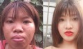 网红砸3亿越南盾整形嫁富二代 摔一跤后打回原形(图)