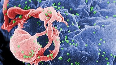 人類免疫缺陷病毒（愛滋病病毒）「human immunodeficiency virus (HIV)」。