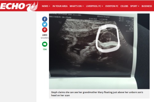 孕妇看完超音波检查照片后哭了一夜