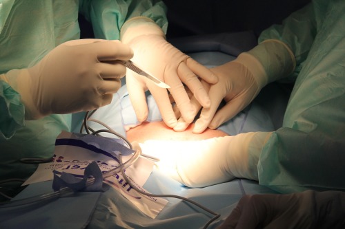 紐西蘭醫界吁停止中國醫生器官移植培訓