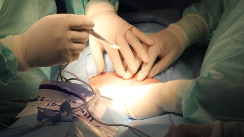 中國是全球器官移植手術最多的國家，中共政權經過數十年的經驗積累後已經採取了更先進的強行獲取器官的手法。
