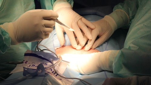 多名医学界专家的分析指出，中国每年进行的大量器官移植手术的器官供体来源存疑。