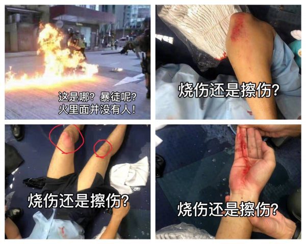 央视11日在其官方微博发文，炮制港警被示威者投汽油弹烧伤的假新闻