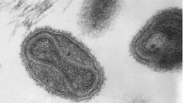 電子顯微鏡下的天花病毒，病毒粒子的中央呈啞鈴狀，內含病毒的去氧核糖核酸