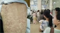 湖南中學爆肺癆校長：不死人不放假(圖)