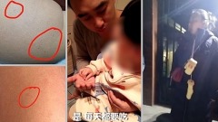 學童不午睡北京幼師打針餵藥引眾怒(圖)