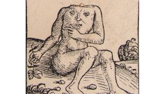 无头人活了三十多年能吃能喝还能生孩子(组图)