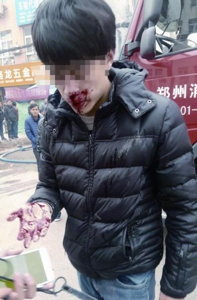报道火灾郑州多名记者遭殴打溅血
