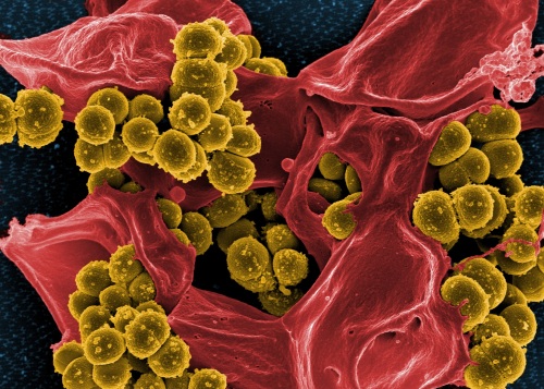 超級細菌 席捲 中國 克痢黴素 農業