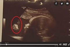 胎儿超音波扫描竟出现酷似耶稣的人像(组图)