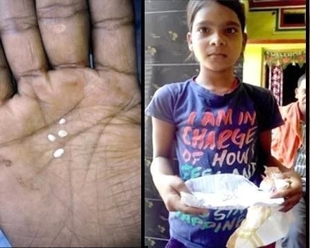 印度11岁女孩每天流“棉花泪”