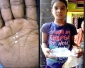 印度11歲女孩每天流「棉花淚」(視頻)