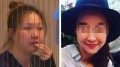 悉尼豐胸致死案第2名被告背景曝光(圖)