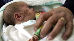 真相难解谈胎记与前世的关系(图)