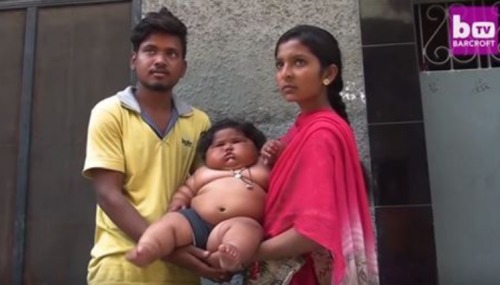 印度1岁女婴每天吃48顿饭全家几乎被吃垮！