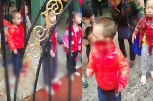 重庆突爆凶案一妇女幼儿园前持刀砍伤十余幼童
