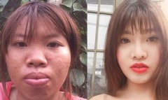 網紅砸3億越南盾整形嫁富二代　摔一跤後打回原形(圖)