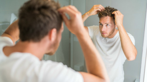 随着年龄增加，男性头发越来越稀疏，同时毛发的生长速度也逐渐缓慢。