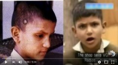 男孩頭部有詭異胎記他記得前世被槍殺