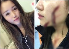 被砍女孩報警1月咋不如發帖1天管用(組圖)