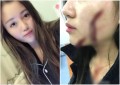 被砍女孩报警1月咋不如发帖1天管用(组图)
