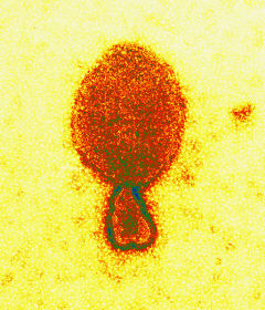 尼帕病毒粒子的彩色透射電子顯微照片長約300 nm