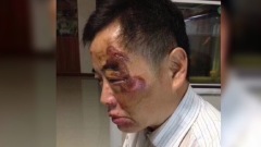 【8.31中國速瞄】電動男供述反殺「龍哥」原因(組圖)