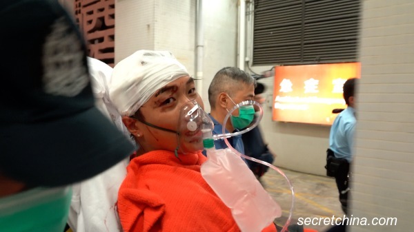 香港民阵召集人岑子杰在旺角遇袭，头部流血，送院时清醒。