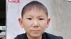 儿时被石砸中头34岁童颜童身(图)