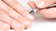 冬天手指易生倒刺教你4招來預防(圖)