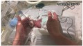 全球最小男嬰平安出院出生僅268公克(圖)