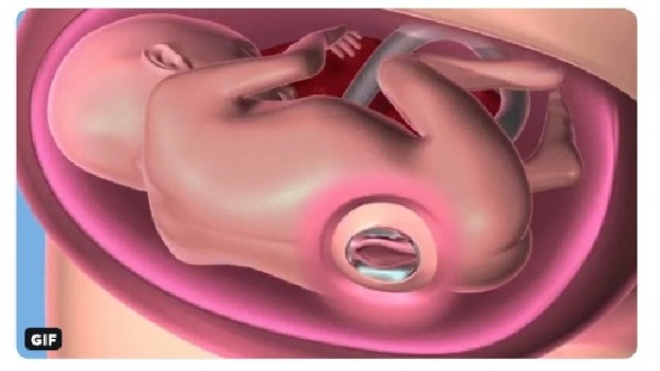 “未出生”就接受子宫内手术的女婴平安诞生