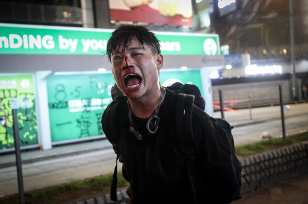 香港医护人员发表声明，称港警助纣为虐，完全是重演六四事件的血腥和残暴，并宣布即日起发起无限期罢工行动。
