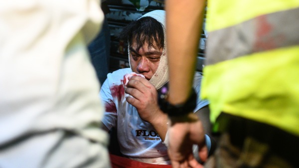 2019年8月5日香港荃湾区抗议活动中发生冲突后，一名受伤男子坐在街上。